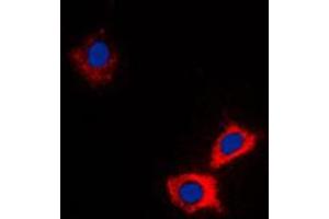 Immunofluorescent analysis of ABCB10 staining in HeLa cells. (ABCB10 antibody  (Center))