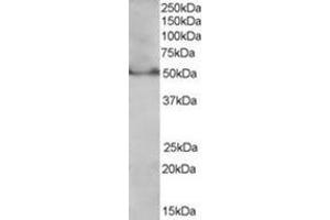 Image no. 1 for anti-Peroxisome Proliferator-Activated Receptor delta (PPARD) (C-Term), (Isoform 1) antibody (ABIN374465) (PPARD antibody  (C-Term, Isoform 1))