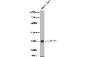 Western blot analysis of extracts of Mouse liver using SULT1C2 Polyclonal Antibody at dilution of 1:1000. (SULT1C2 antibody)