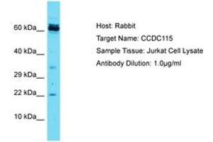 Image no. 1 for anti-Coiled-Coil Domain Containing 115 (CCDC115) (AA 47-96) antibody (ABIN6750443) (CCDC115 antibody  (AA 47-96))