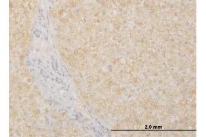 Immunoperoxidase of monoclonal antibody to POMGNT1 on formalin-fixed paraffin-embedded human liver. (POMGNT1 antibody  (AA 221-318))
