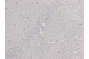 Immunohistochemistry (IHC) image for anti-Tubulin, beta 3 (TUBB3) antibody (ABIN1112834) (TUBB3 antibody)