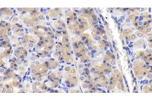 Detection of NUP85 in Human Stomach Tissue using Polyclonal Antibody to Nucleoporin 85 (NUP85)