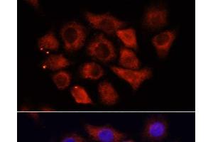 Immunofluorescence analysis of HeLa cells using HMGA1 Polyclonal Antibody at dilution of 1:100 (40x lens). (HMGA1 antibody)