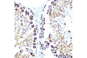 Immunohistochemistry of paraffin-embedded rat testis using STIP1 Rabbit pAb (ABIN6133089, ABIN6148592, ABIN6148593 and ABIN6218351) at dilution of 1:100 (40x lens). (STIP1 antibody  (AA 1-300))