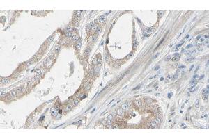 ABIN6272312 at 1/100 staining Human prostate tissue by IHC-P. (GRAP antibody)