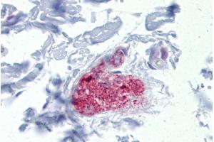 Immunohistochemistry with Colon, submucosal plexus tissue at an antibody concentration of 5µg/ml using anti-NOTCH4 antibody (ARP32052_P050) (NOTCH4 antibody  (Middle Region))
