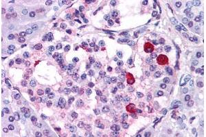 Anti-GIPR antibody  ABIN1048656 IHC staining of human pancreas. (GIPR antibody  (N-Term))