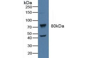Detection of BARK in Human Raji Cells using Polyclonal Antibody to Beta Adrenergic Receptor Kinase (BARK) (beta-Adrenergic Receptor Kinase (AA 398-640) antibody)