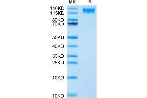 Human LEPR on Tris-Bis PAGE under reduced condition. (Leptin Receptor Protein (LEPR) (AA 22-839) (His tag))