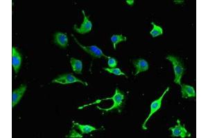 Immunofluorescent analysis of U251 cells using ABIN7161179 at dilution of 1:100 and Alexa Fluor 488-congugated AffiniPure Goat Anti-Rabbit IgG(H+L) (Nestin antibody  (AA 1321-1569))