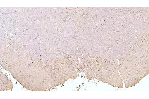 Detection of TH in Mouse Cerebrum Tissue (under 5x lens) using Polyclonal Antibody to Tyrosine Hydroxylase (TH)