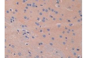 Immunohistochemistry (IHC) image for anti-Hexosaminidase B (Beta Polypeptide) (HEXB) (AA 294-435) antibody (ABIN7438139)
