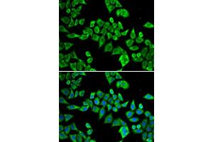 Immunofluorescence analysis of HeLa cell using DDX20 antibody. (DDX20 antibody)