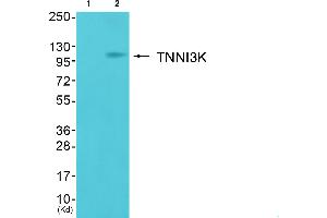 Western blot analysis of extracts from cos-7 cells (Lane 2), using TNNI3K Antibody. (TNNI3K antibody  (Internal Region))