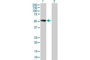Western Blot analysis of MAP2K7 expression in transfected 293T cell line by MAP2K7 monoclonal antibody (M05), clone 6A4. (MAP2K7 antibody  (AA 1-99))