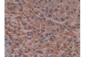 DAB staining on IHC-P; Samples: Human Liver Tissue (Reelin antibody  (AA 3142-3460))