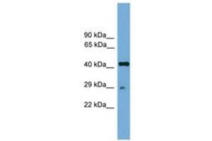 Image no. 1 for anti-Regulatory Factor X-Associated Protein (RFXAP) (AA 101-150) antibody (ABIN6744620) (RFXAP antibody  (AA 101-150))