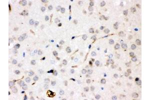 IHC testing of FFPE rat brain with CP antibody. (Ceruloplasmin antibody  (AA 20-258))