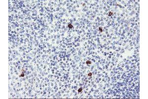 Immunohistochemical staining of paraffin-embedded Human tonsil using anti-RPS6KB1 mouse monoclonal antibody.