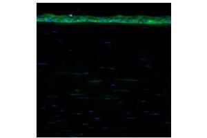 ALDH1A1 antibody used at a dilution of 1:200 to detect human cornea. (ALDH1A1 antibody  (Middle Region))