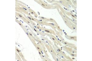 Immunohistochemistry of paraffin-embedded mouse heart using UPF1/RENT1 antibody  at dilution of 1:100 (40x lens).