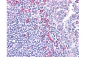Immunohistochemistry (IHC) image for anti-delta-Like 1 (DLL1) (N-Term) antibody (ABIN2782684) (DLL1 antibody  (N-Term))