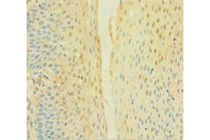 Immunohistochemistry of paraffin-embedded human tonsil tissue using ABIN7149094 at dilution of 1:100 (CYBB antibody  (AA 283-570))