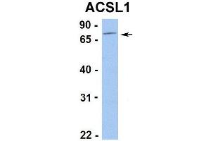Hum. (ACSL1 antibody  (C-Term))