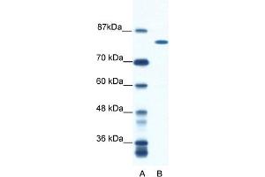 WB Suggested Anti-DHX16 Antibody Titration:  0.