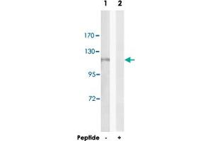 Western blot analysis of extracts from HeLa cells, using AOX1 polyclonal antibody . (AOX1 antibody)