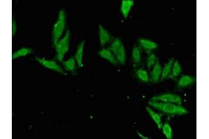 Immunofluorescent analysis of Hela cells using ABIN7155691 at dilution of 1:100 and Alexa Fluor 488-congugated AffiniPure Goat Anti-Rabbit IgG(H+L) (EN2 antibody  (AA 1-251))