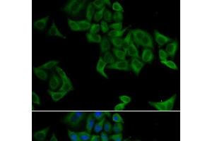 SMYD5 antibody