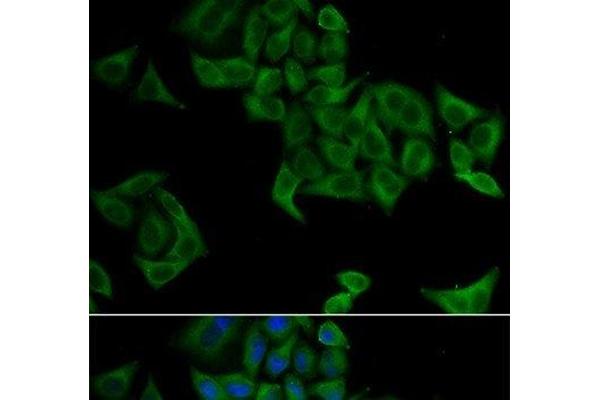 SMYD5 antibody