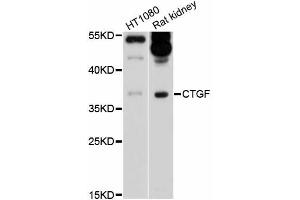 Western blot analysis of extracts of various cell lines, using CTGF antibody (ABIN5997528) at 1/1000 dilution. (CTGF antibody)