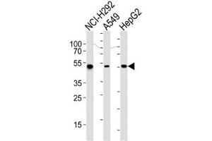 Western blot analysis of lysate from NCI-H292, A549, HepG2 cell line (left to right) using ALDH2 antibody at 1:1000 for each lane. (ALDH2 antibody)