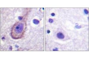 Immunohistochemistry analysis of paraffin-embedded human brain, using Kv7. (KCNQ3 antibody  (pThr217))