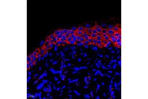 Immunofluorescent analysis of paraffin embedded rat bladder using PMCA1 (ABIN7073155) at dilution of 1: 500 (ATP2B1 antibody)