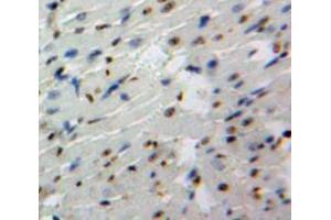 Used in DAB staining on fromalin fixed paraffin-embedded Heart tissue (GATA4 antibody  (AA 201-442))