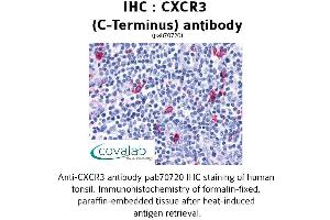 Image no. 1 for anti-Chemokine (C-X-C Motif) Receptor 3 (CXCR3) (C-Term) antibody (ABIN1733397) (CXCR3 antibody  (C-Term))
