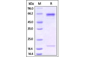 Biotinylated Mouse PCSK9 on SDS-PAGE under reducing (R) condition. (PCSK9 Protein (AA 35-694) (His tag,AVI tag,Biotin))