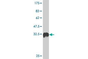 Western Blot detection against Immunogen (35. (ALDOB antibody  (AA 88-170))