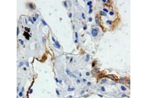 Used in DAB staining on fromalin fixed paraffin-embedded lung tissue (SFTPB antibody  (AA 201-381))