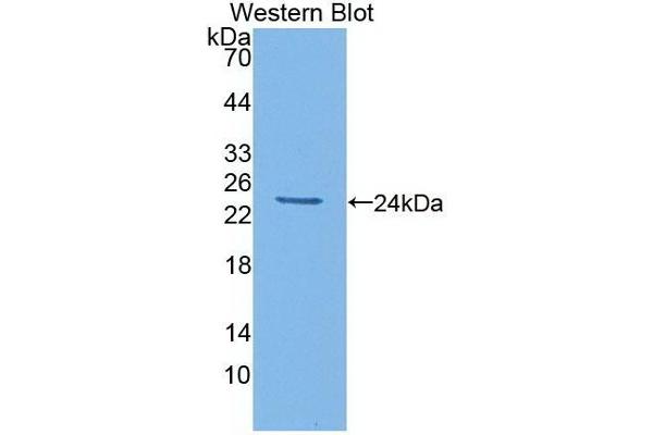 IL-6 Antikörper  (AA 21-211)
