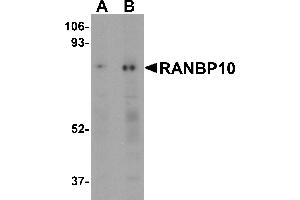 Western Blotting (WB) image for anti-RAN Binding Protein 10 (RANBP10) (Middle Region) antibody (ABIN1031052) (RANBP10 antibody  (Middle Region))