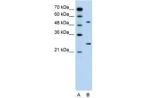 CACNB1 antibody used at 0. (CACNB1 antibody  (Middle Region))