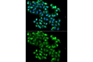 Immunofluorescence analysis of A549 cells using PHF11 antibody (ABIN5975729). (PHF11 antibody)