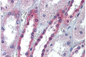 Human Kidney: Formalin-Fixed, Paraffin-Embedded (FFPE) (Occludin antibody  (AA 35-84))