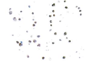 Immunocytochemistry (ICC) image for anti-Thymus High Mobility Group Box Protein (TOX) (AA 50-100) antibody (ABIN7453374)