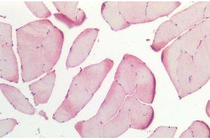 Immunohistochemistry analysis using Rabbit Anti-HSP27 Polyclonal Antibody (ABIN1027725 and ABIN1027726). (HSP27 antibody)